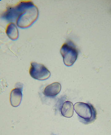 amylo-spermata1
